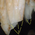The damaged formations in Missouri's Crystal Caverns.
