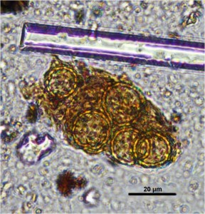 Fossilised pollen of Chenopodiaceae which appeared on the tomb
