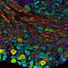 Bat sensory neurons.